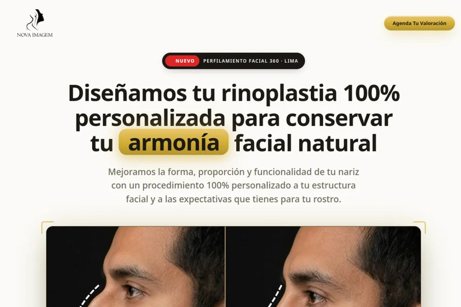 Landing de Nova Imagem: Agenda tu cita de rinoplastia